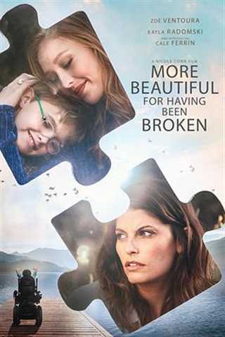 免费在线观看《More Beautiful for Having Been Broken/美好正逢时》